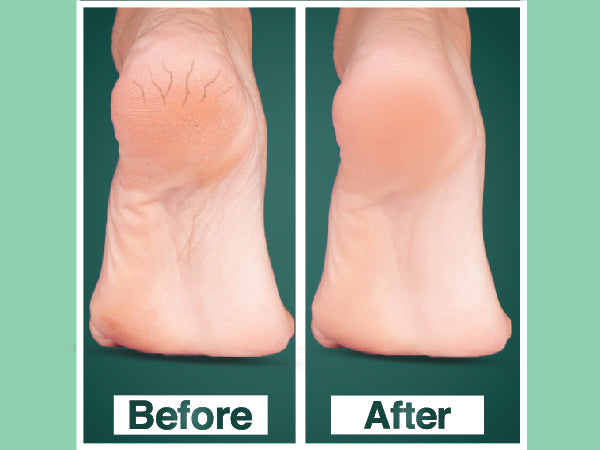 Olivia Softening Foot Cream with Eucalyptus & Peppermint